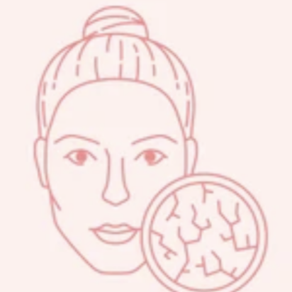 Sensitiv/Rosacea